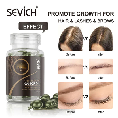 Sevich 30Pcs/bottle Ginger Anti-Hair Loss Capsules Hair Growth Conditioning Oil Vitamin Repair Dry Hair Scalp Care Products